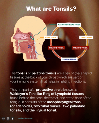 Did You Know That Your Tonsil Health Can Affect Your Heart Dr Ruth